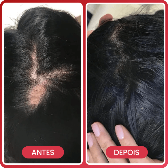Antes e depois 1