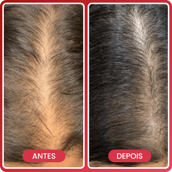 Antes e depois 3