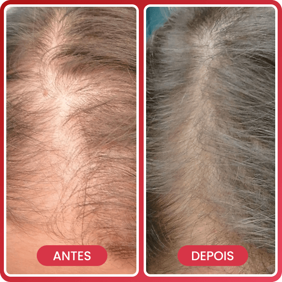 Antes e depois 4